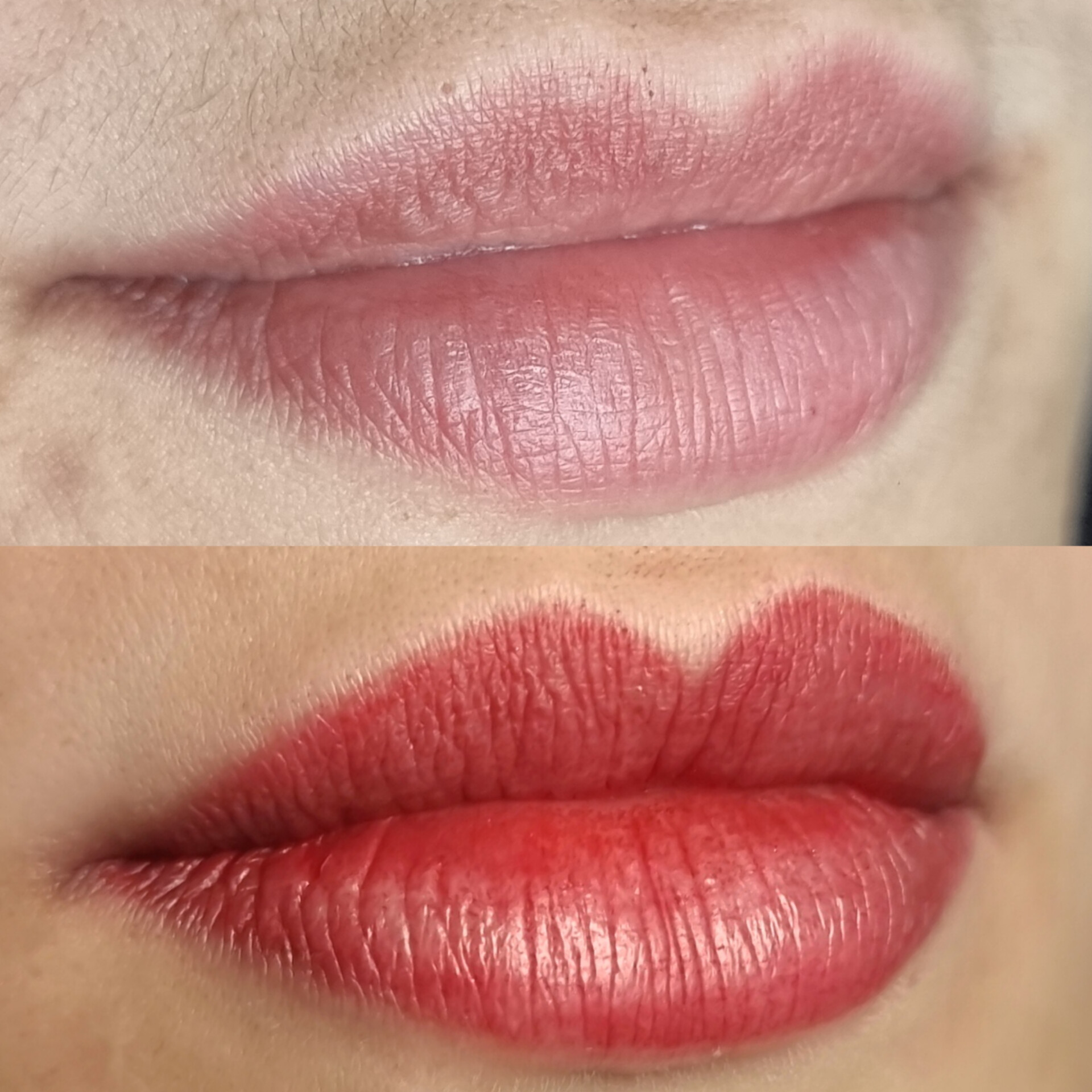 Micro Labial em Sobradinho DF 12