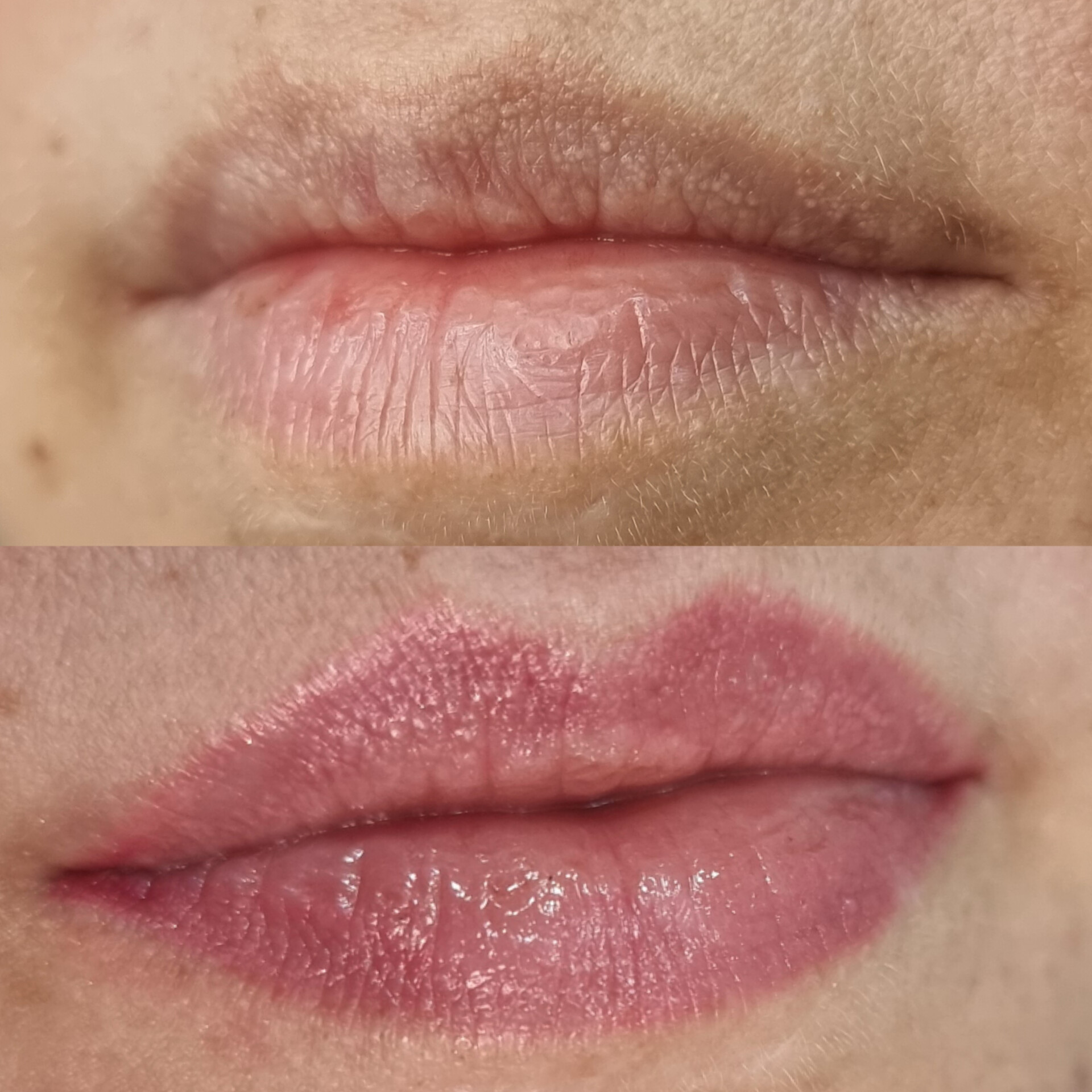 Micro Labial em Sobradinho DF 13