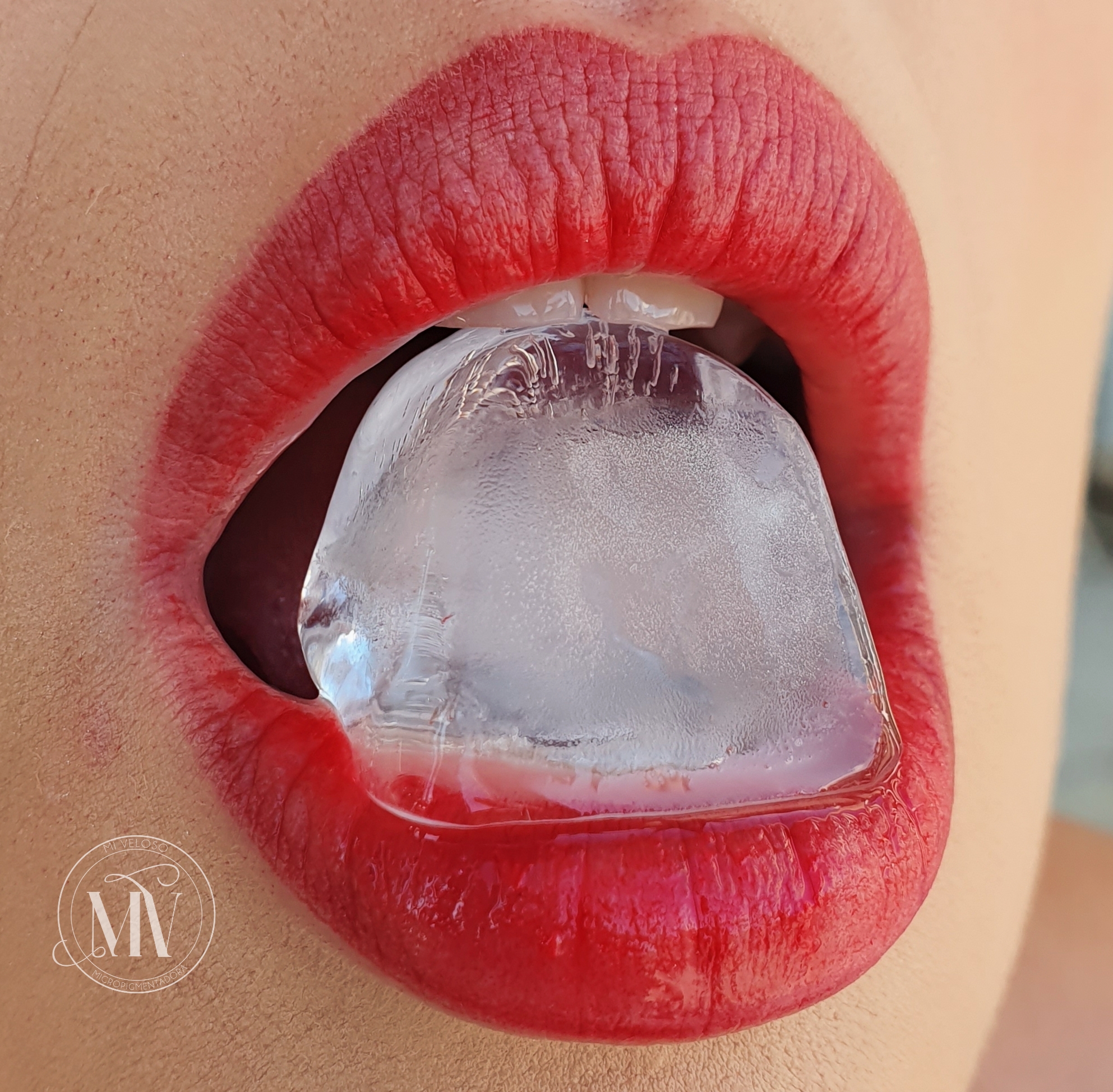 Micro Labial em Sobradinho DF 15