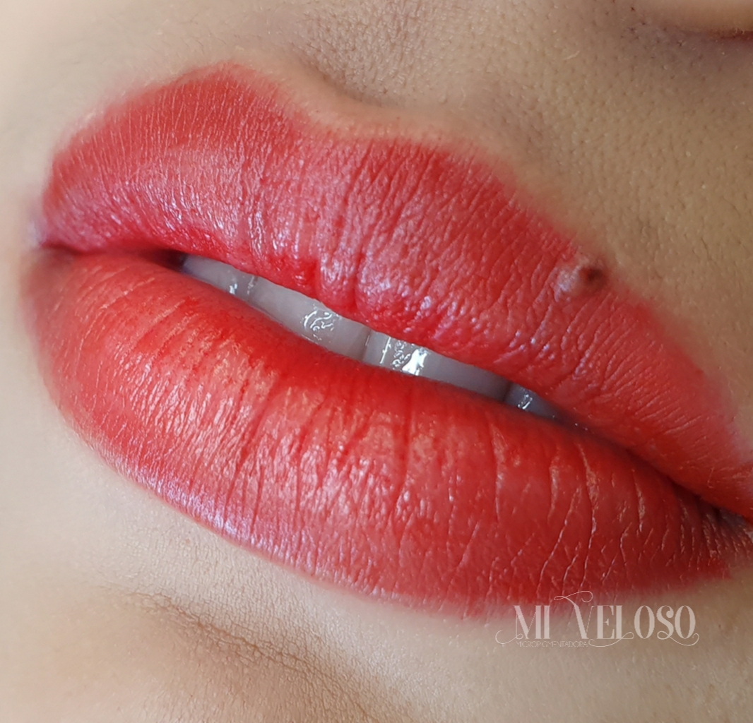 Micro Labial em Sobradinho DF 17