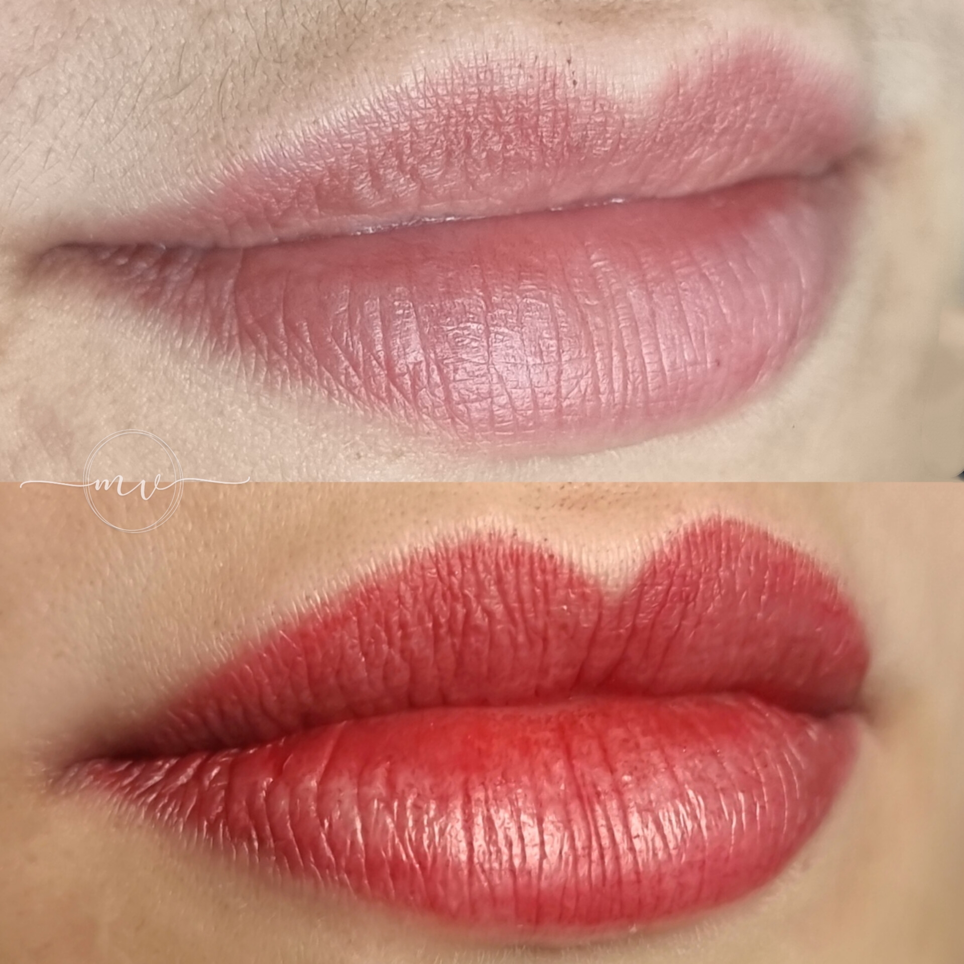 Micro Labial em Sobradinho DF 18