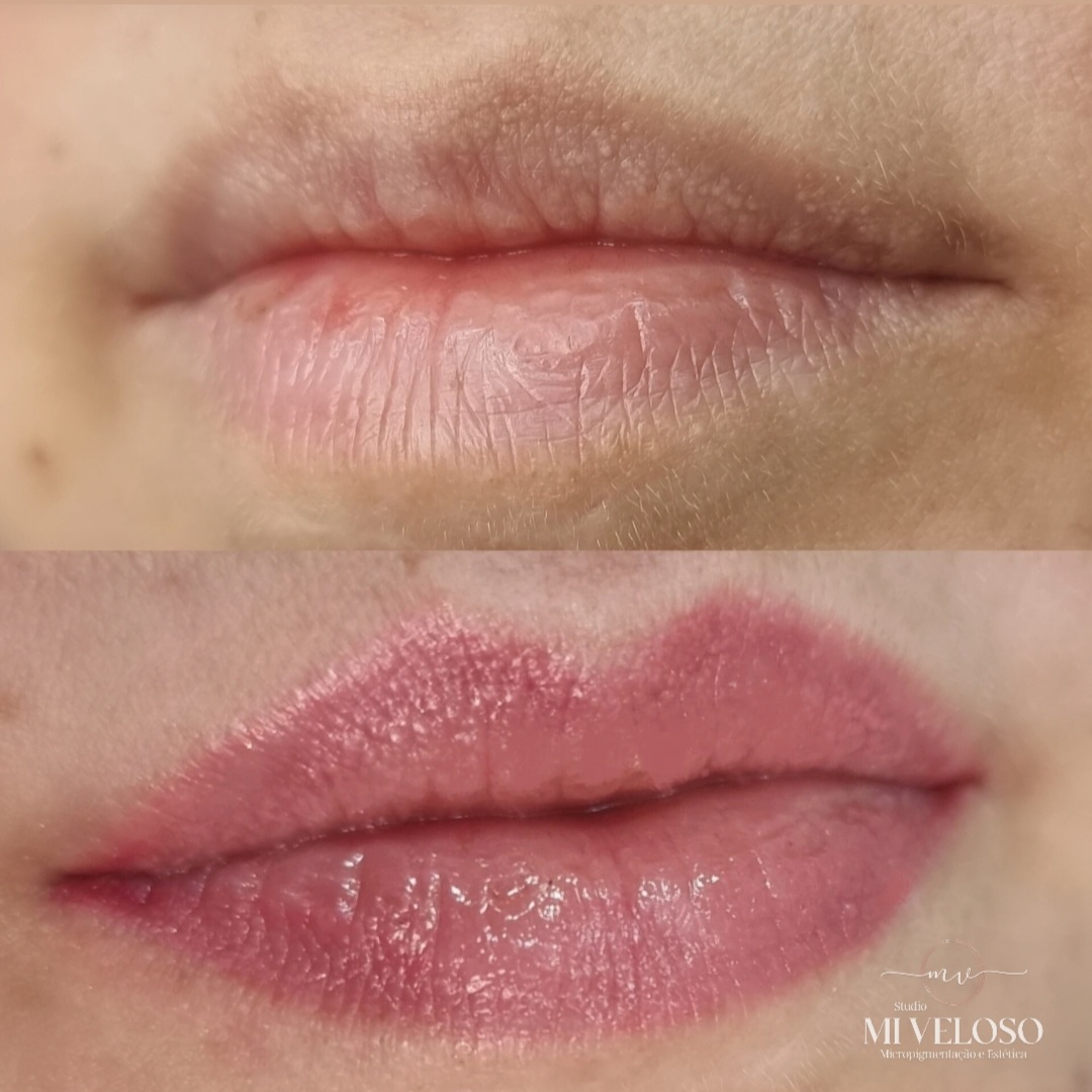 Micro Labial em Sobradinho DF 19