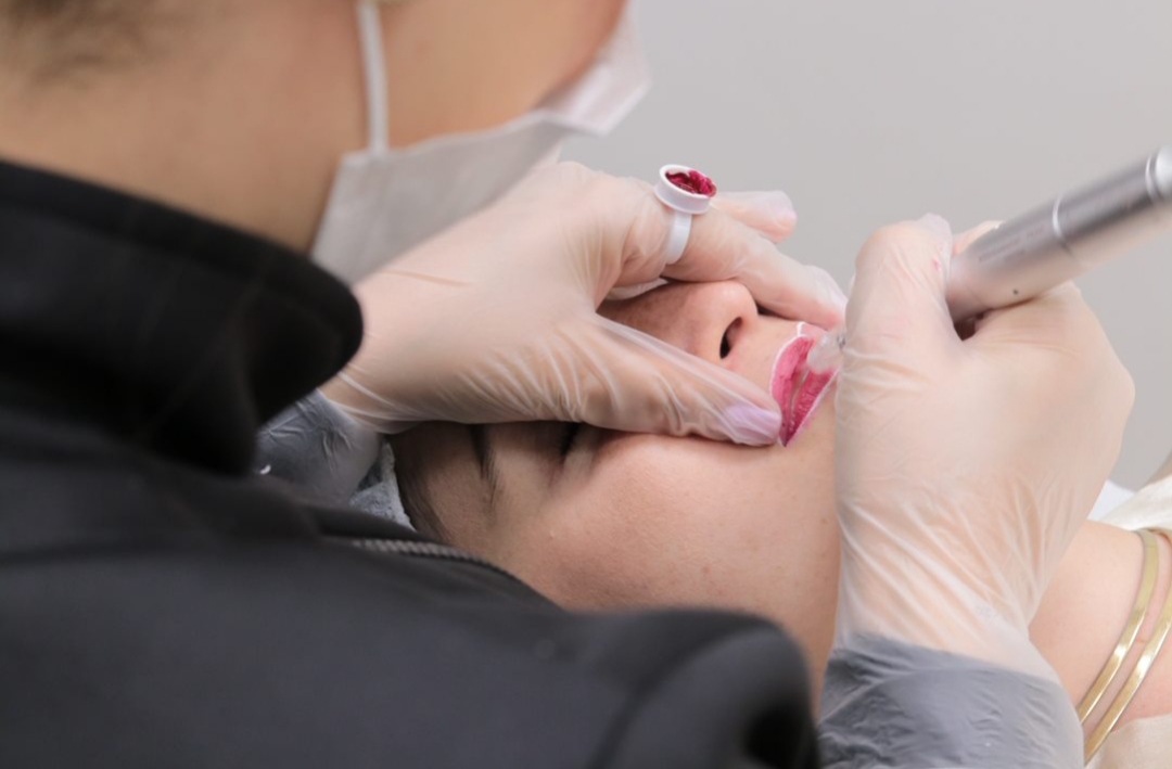 Micro Labial em Sobradinho DF 5