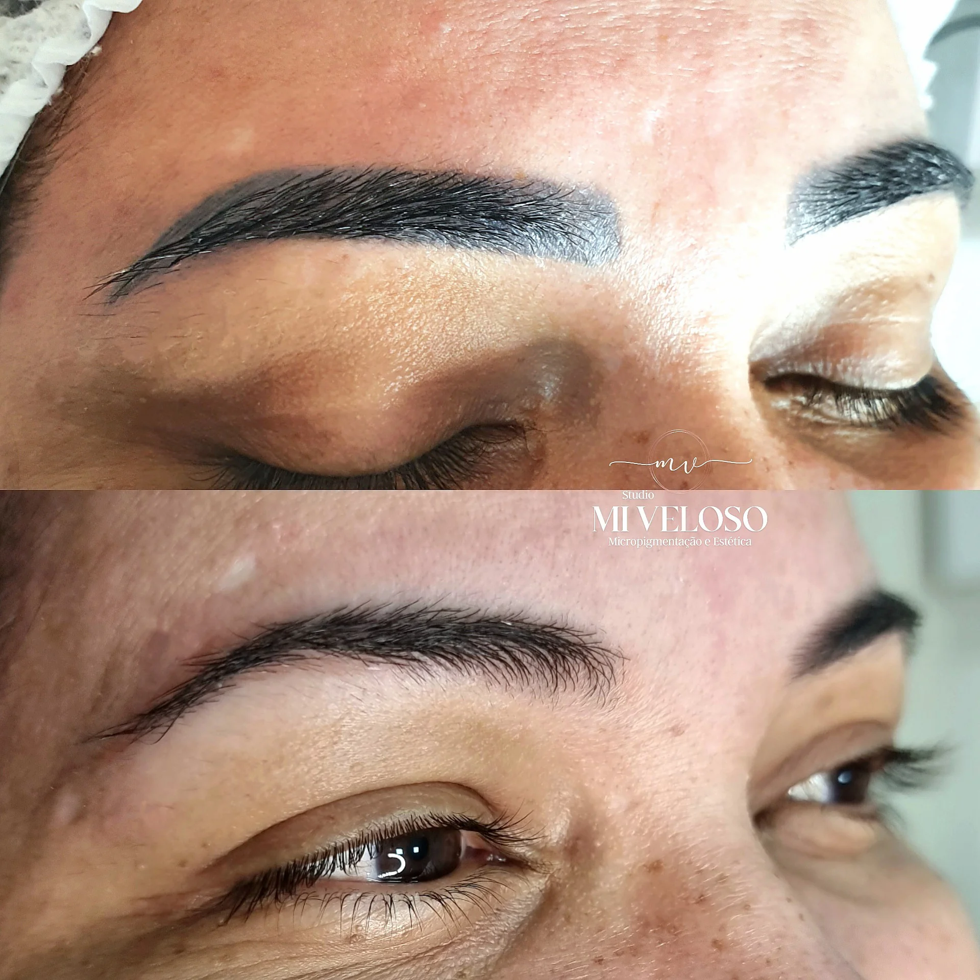 Despigmentação de Sobrancelhas DF-05