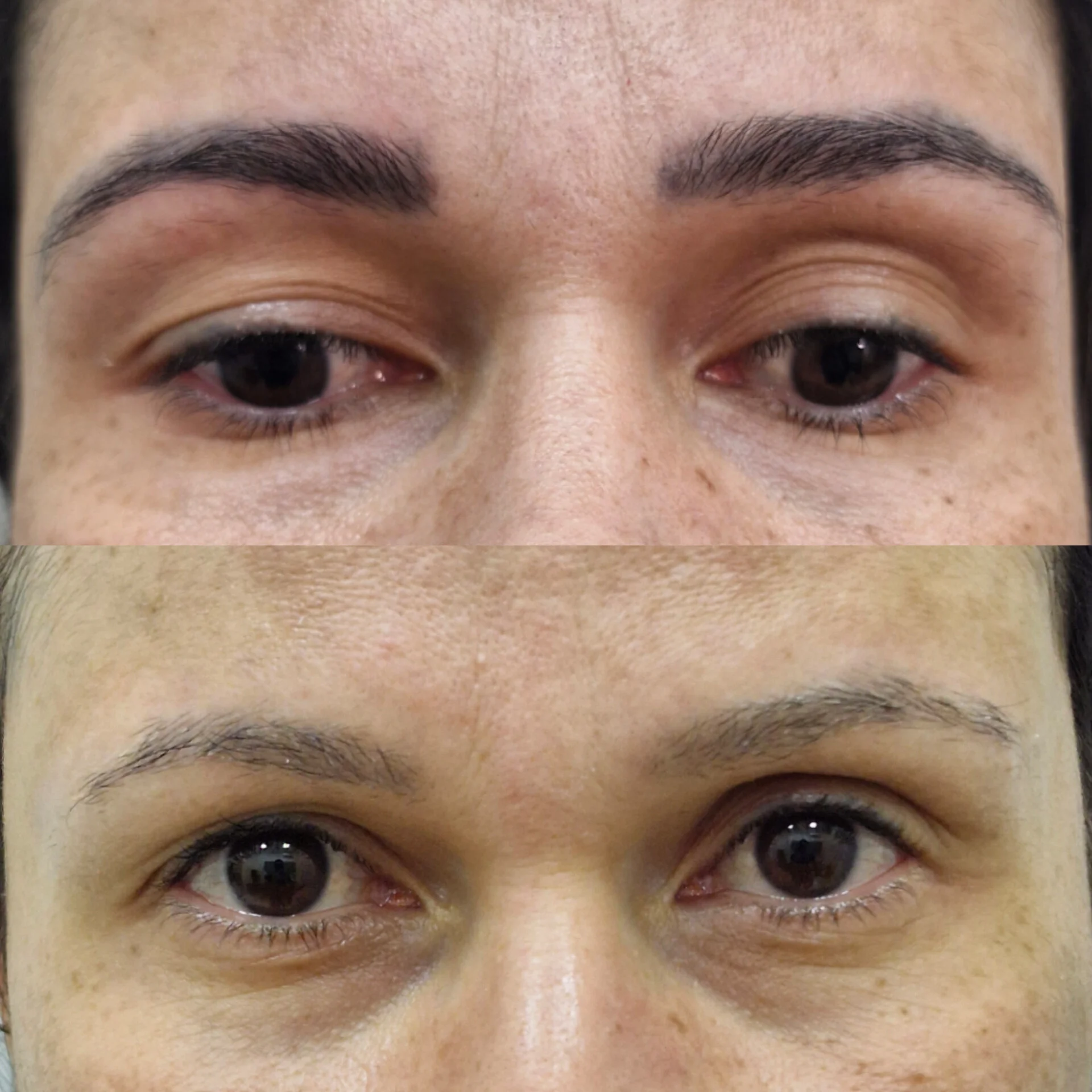 Despigmentação de Sobrancelhas DF-07