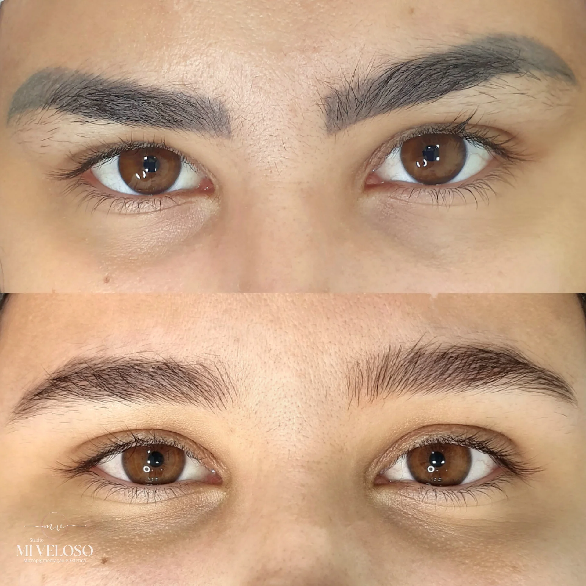 Despigmentação de Sobrancelhas DF-10