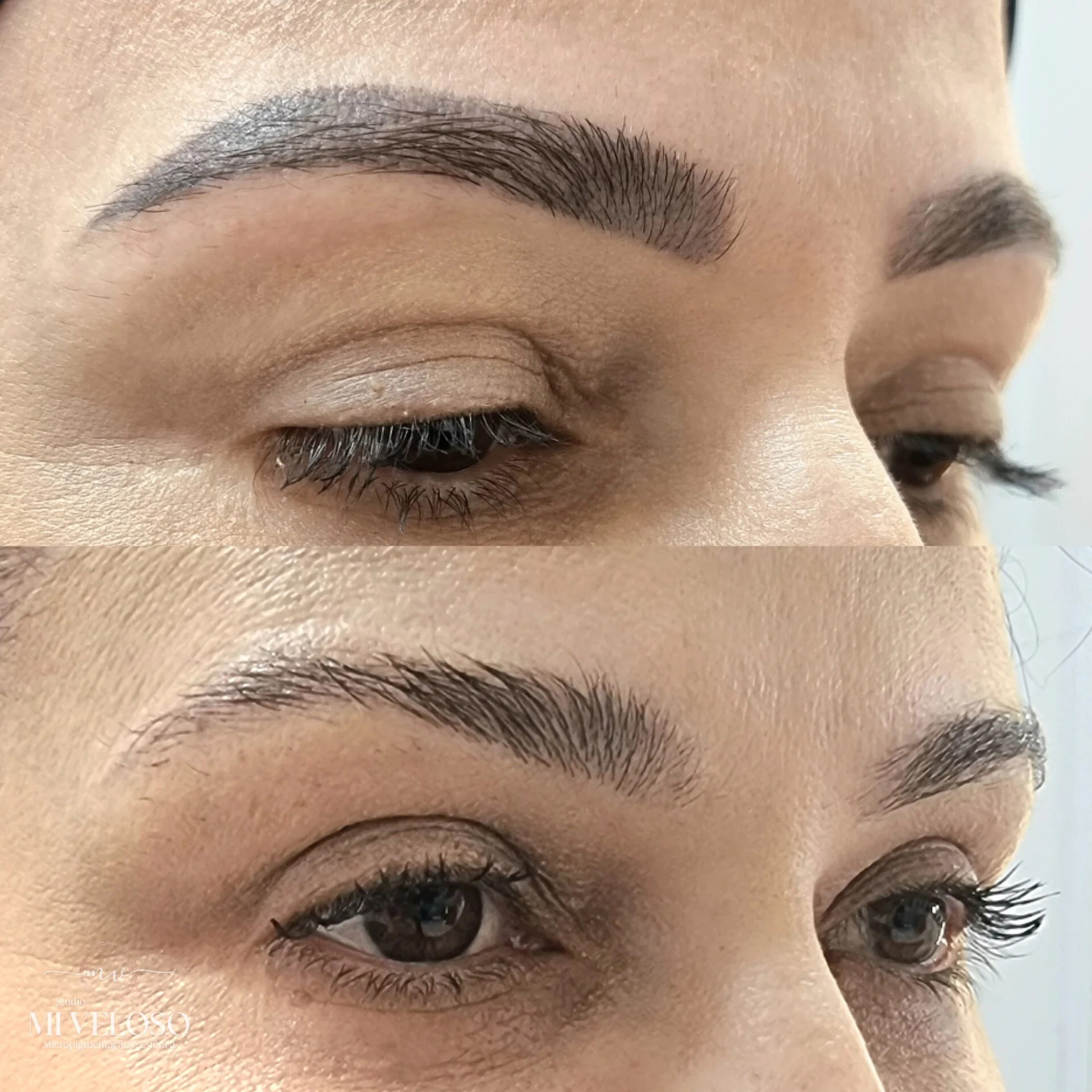 Despigmentação de Sobrancelhas DF-11