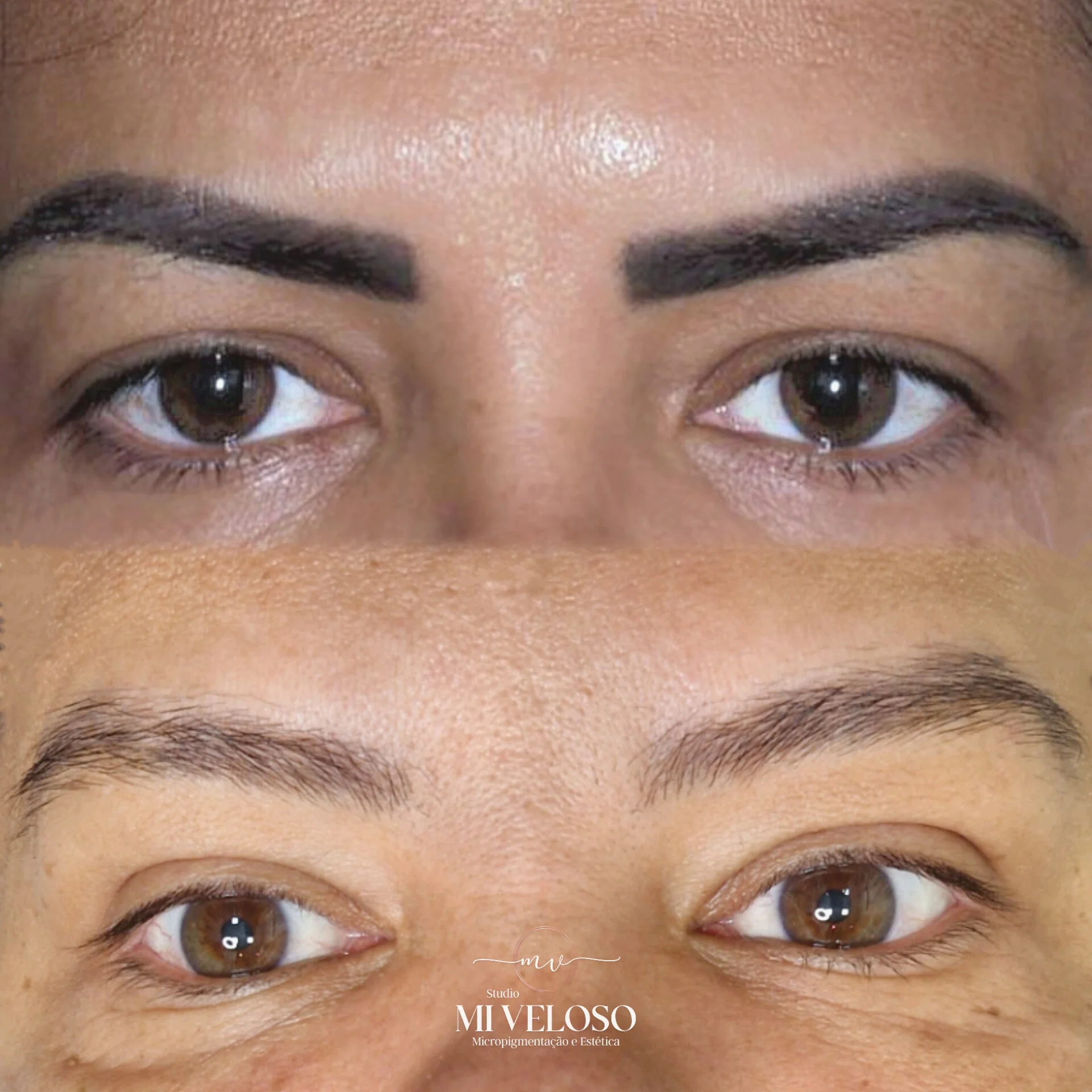 Despigmentação de Sobrancelhas DF-12