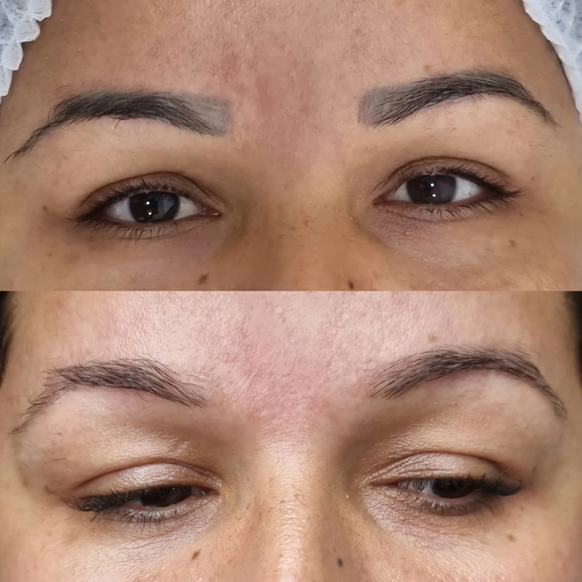 Despigmentação de Sobrancelhas DF-14