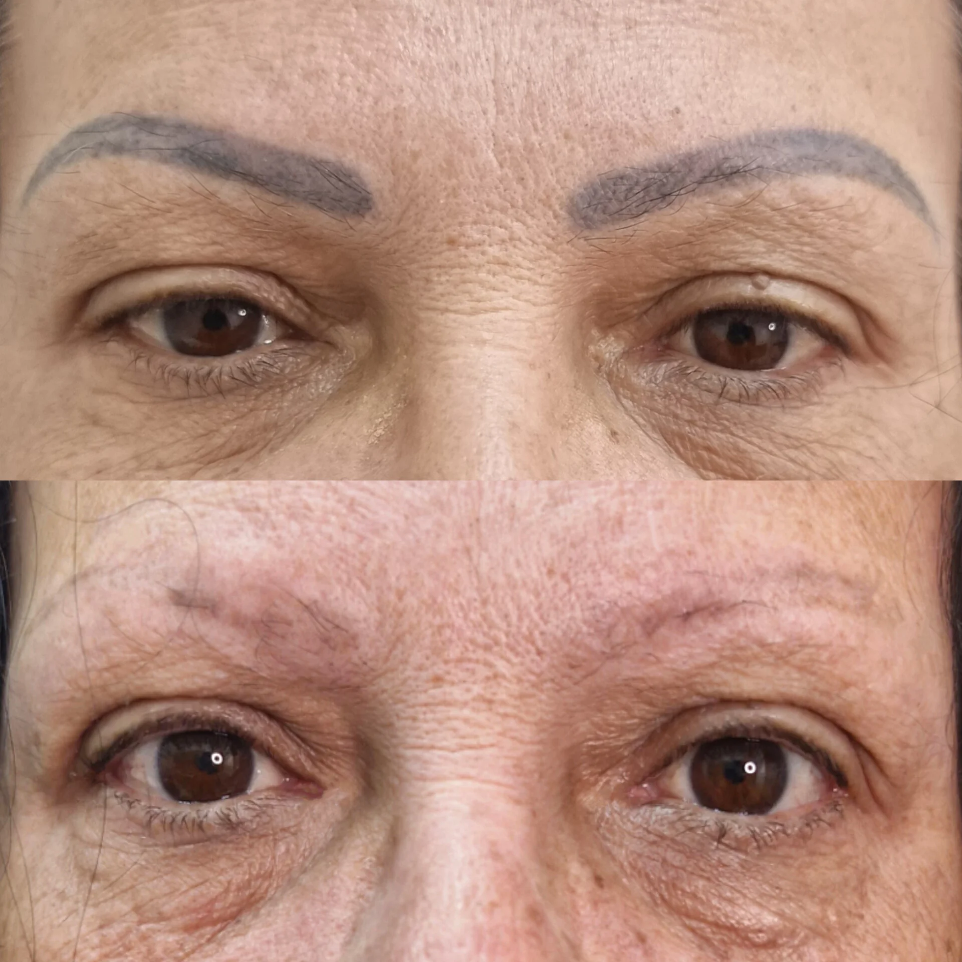 Despigmentação de Sobrancelhas DF-16