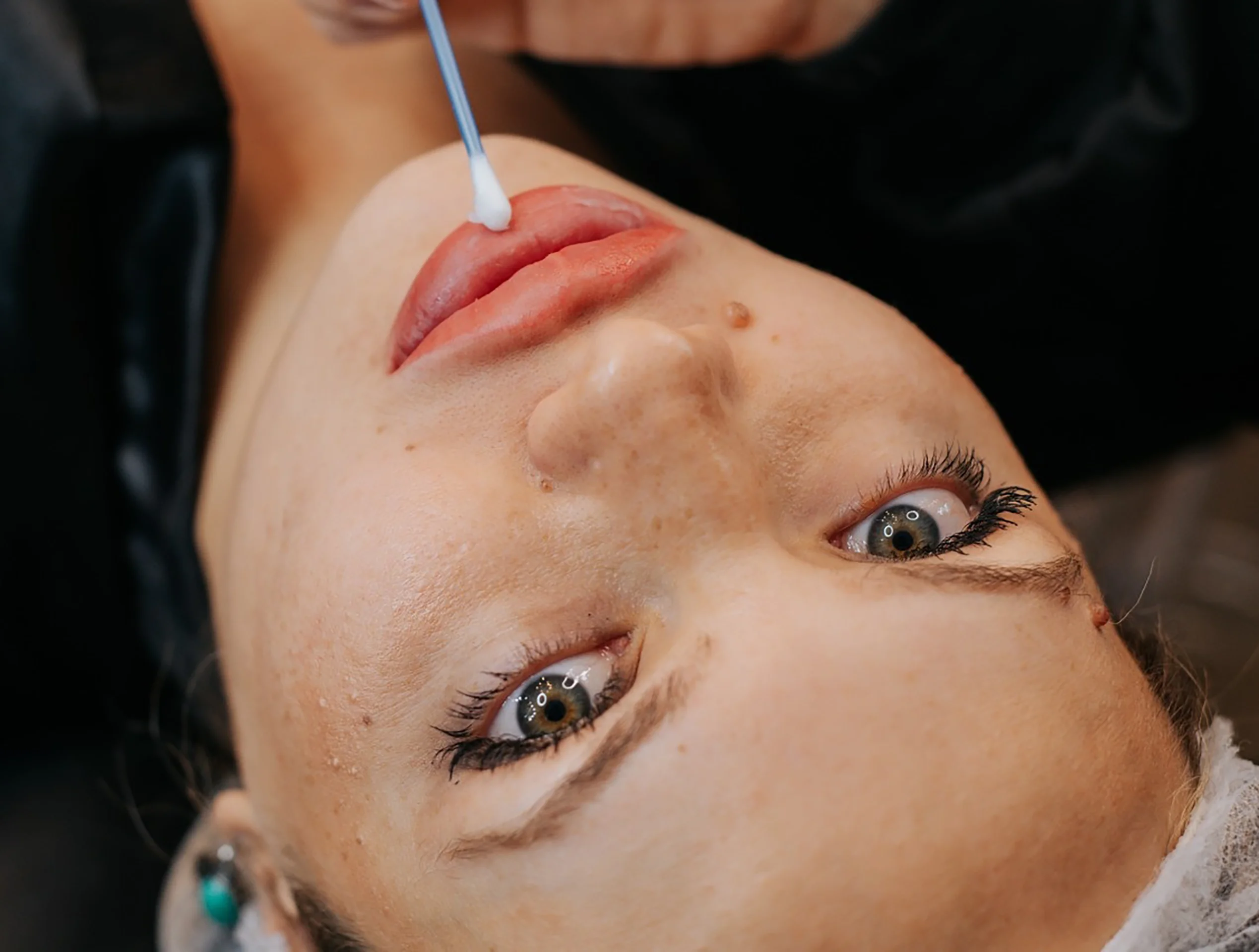 Micro-Labial-em-Sobradinho-DF-05
