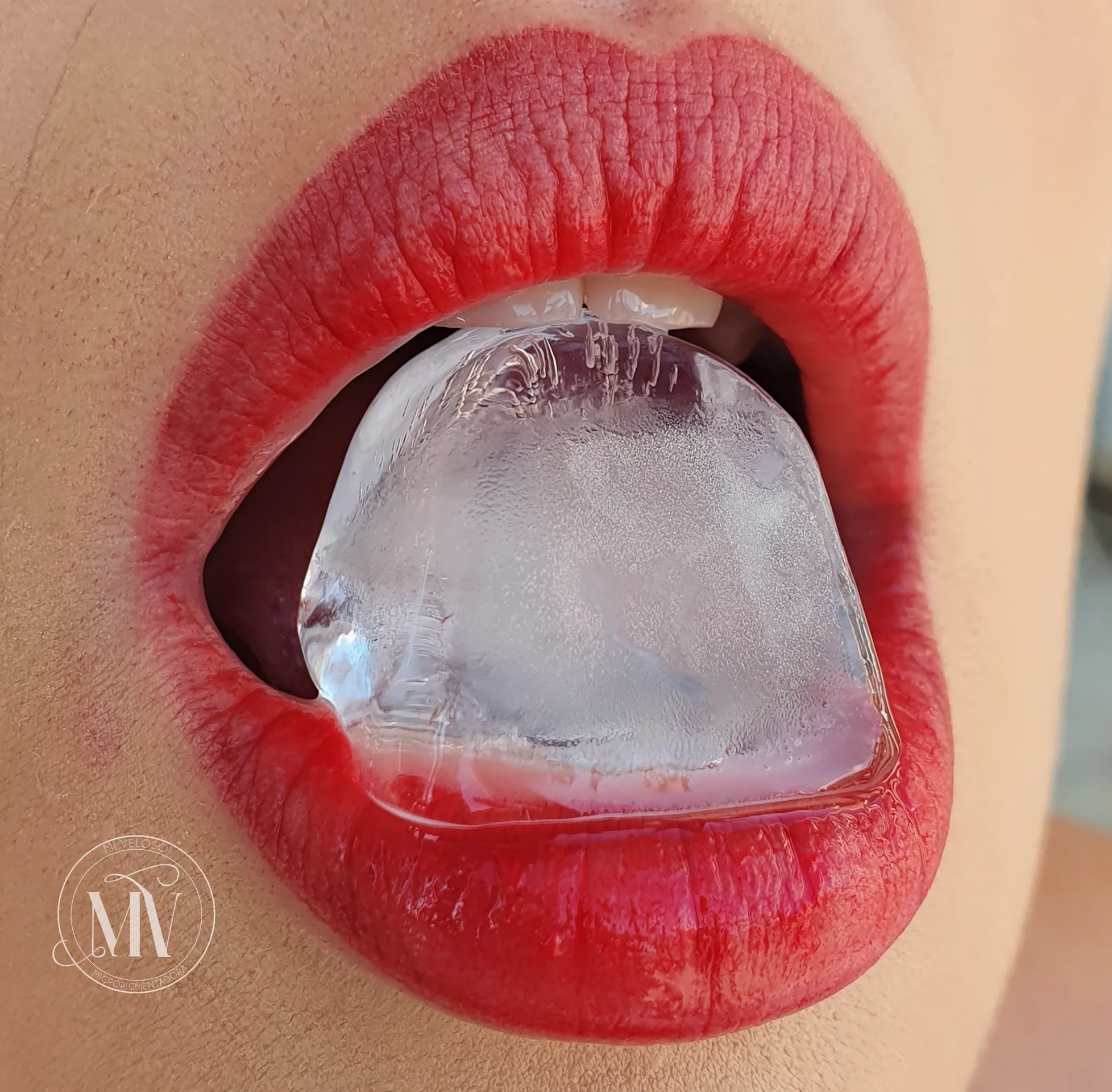 Micro-Labial-em-Sobradinho-DF-13