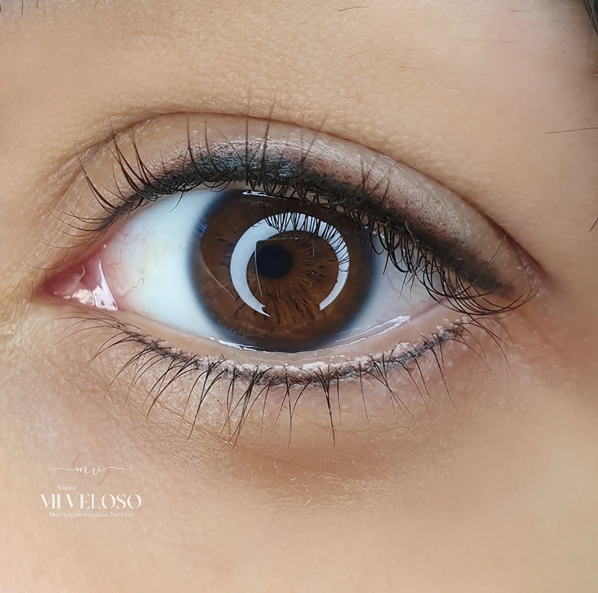 Micropimentação-Olhos-DF-06